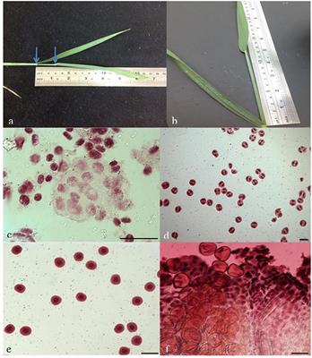 Both Male and Female Malfunction Contributes to Yield Reduction under Water Stress during Meiosis in Bread Wheat